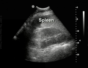 Ultrasound Spleen L Kidney Glass Horse