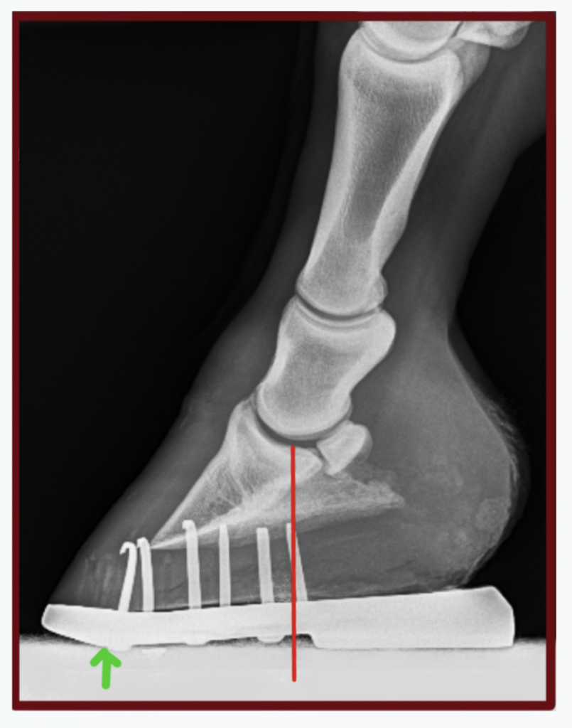 Here, a similar shoe with more wedge, improved center of rotation and breakover moved back further. The horse was still not very comfortable. 